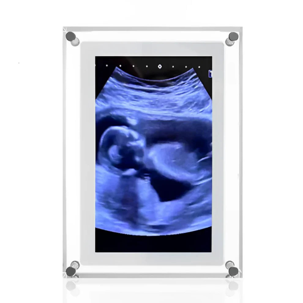 BabyFrame NuoveMamme™ – Il Ricordo Più Dolce della Tua Gravidanza 💕