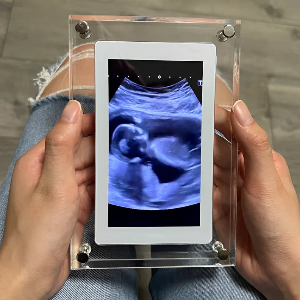 BabyFrame NuoveMamme™ – Il Ricordo Più Dolce della Tua Gravidanza 💕
