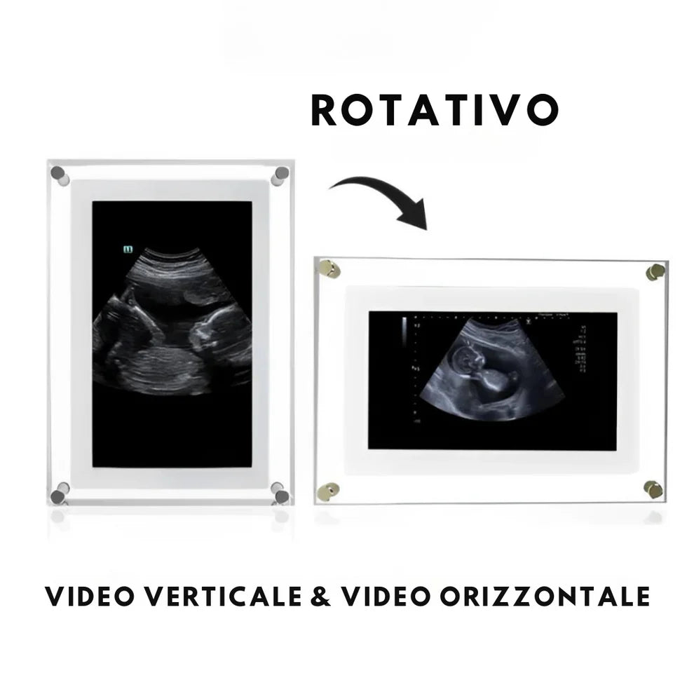 BabyFrame NuoveMamme™ – Il Ricordo Più Dolce della Tua Gravidanza 💕