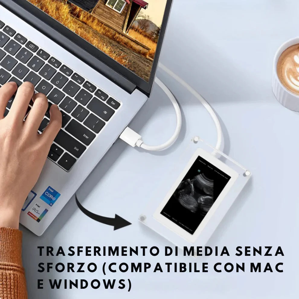 BabyFrame NuoveMamme™ – Il Ricordo Più Dolce della Tua Gravidanza 💕